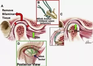 Disfunção da ATM Disfunção da ATM